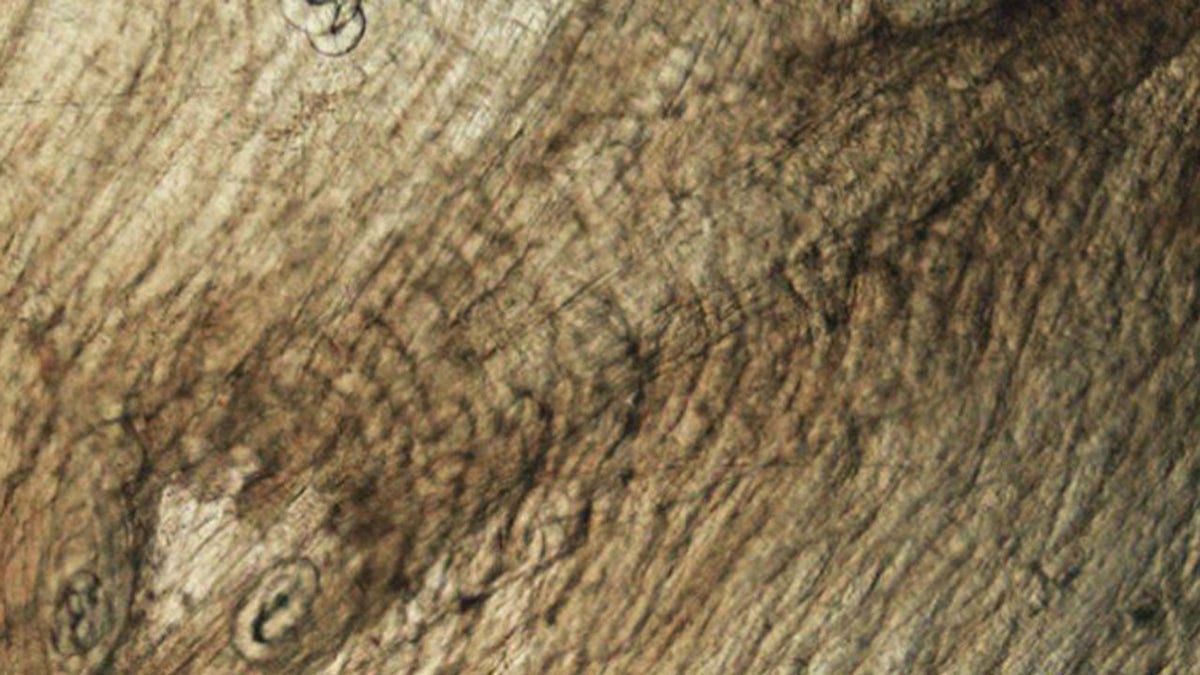 Undercooked bear meat to blame for infecting family with rare roundworm parasite: CDC