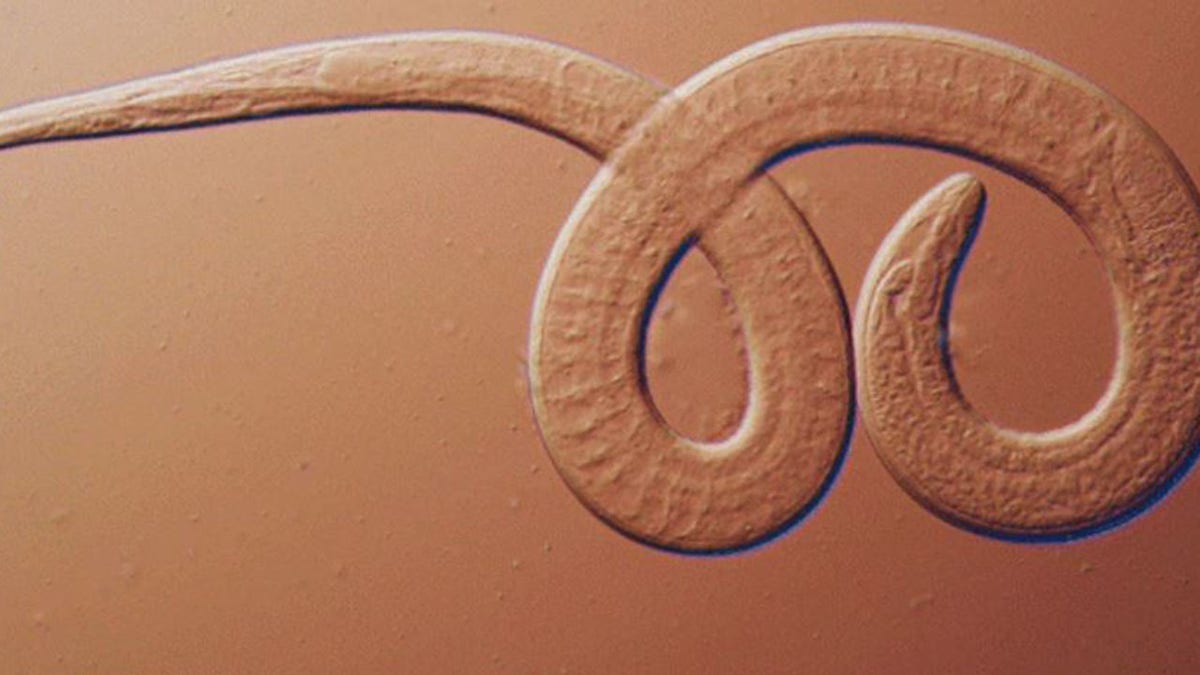 Undercooked bear meat to blame for infecting family with rare roundworm parasite: CDC