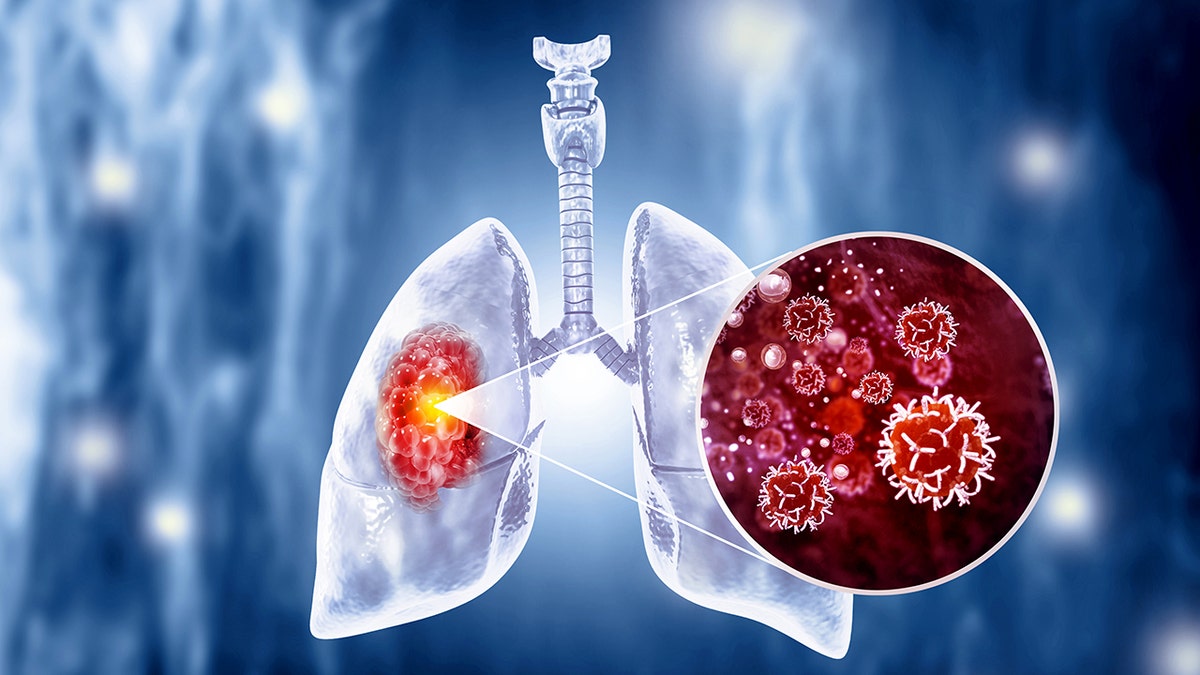 Honeybees can detect lung cancer, researchers say